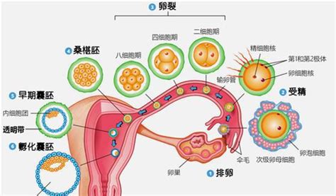 畸形精子