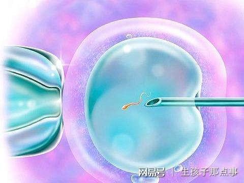 盆底肌电疗