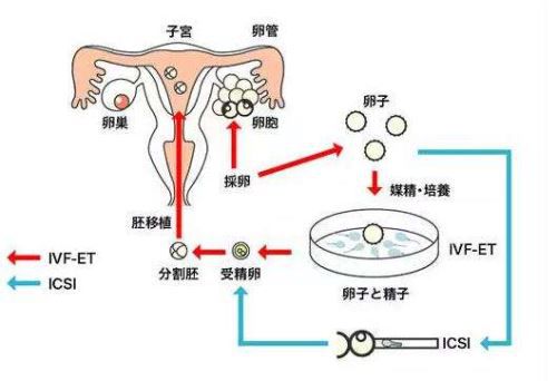 盐城捐卵公司