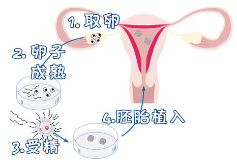痛经