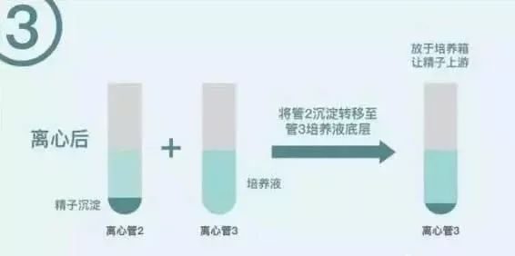 男性生殖科检查