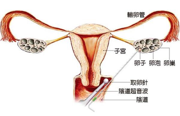 男性健康