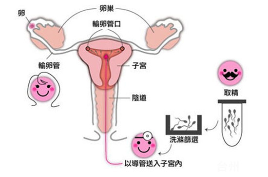男性不孕不育