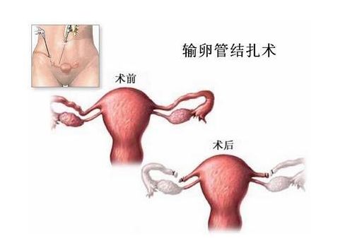 盐城代怀孕捐卵