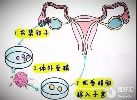男性不孕检查